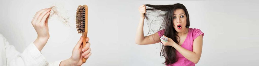 عوامل ریزش مو در خانم ها